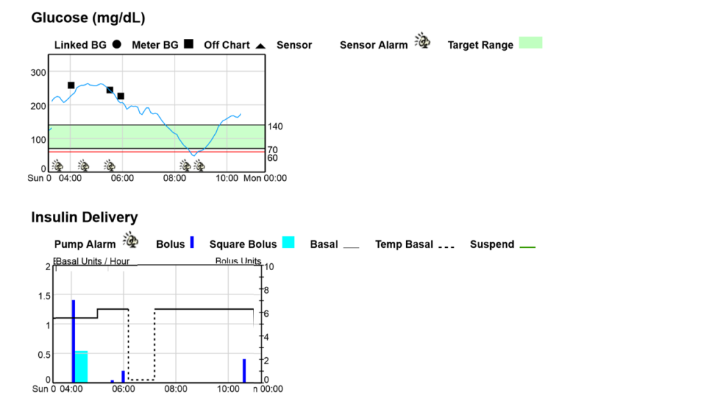 diabetes running and sugars running charts from CGMS