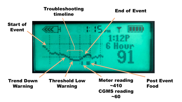 CGMS, CGMS reading, Medtronic CGMS reading