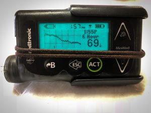 medtronic, cgms, Derby 50k, Derby Ultramarathon