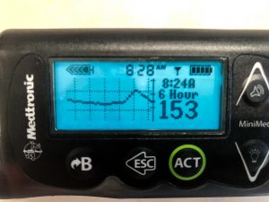 Paradigm Insulin Pump with CGMS