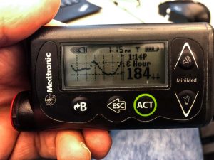 Paradigm Insulin Pump with CGMS