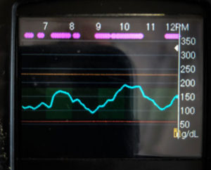 glucose trend information during an event